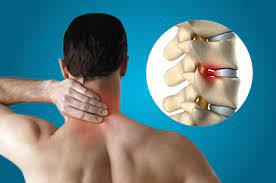 Ayurvedic Herbal Treatment For Cervical Disc Problems
